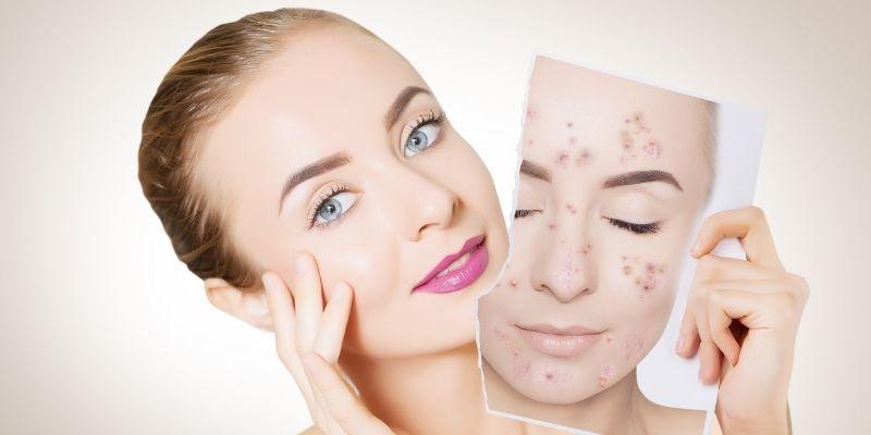 Your 2-Week Plan to Clearer Skin