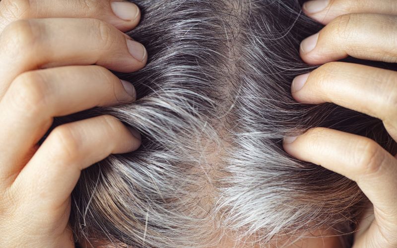 Gray roots