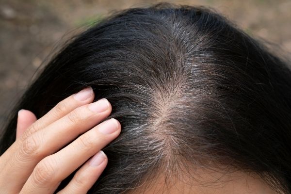 Hair roots